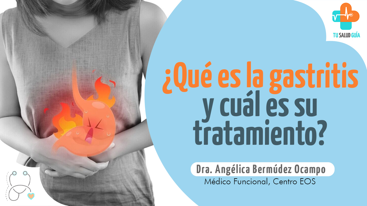 ¿Qué es la gastritis y cuál es su tratamiento? Directorio Médico Tu