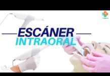 Escáner intraoral: qué es, para qué sirve y qué ventajas ofrece